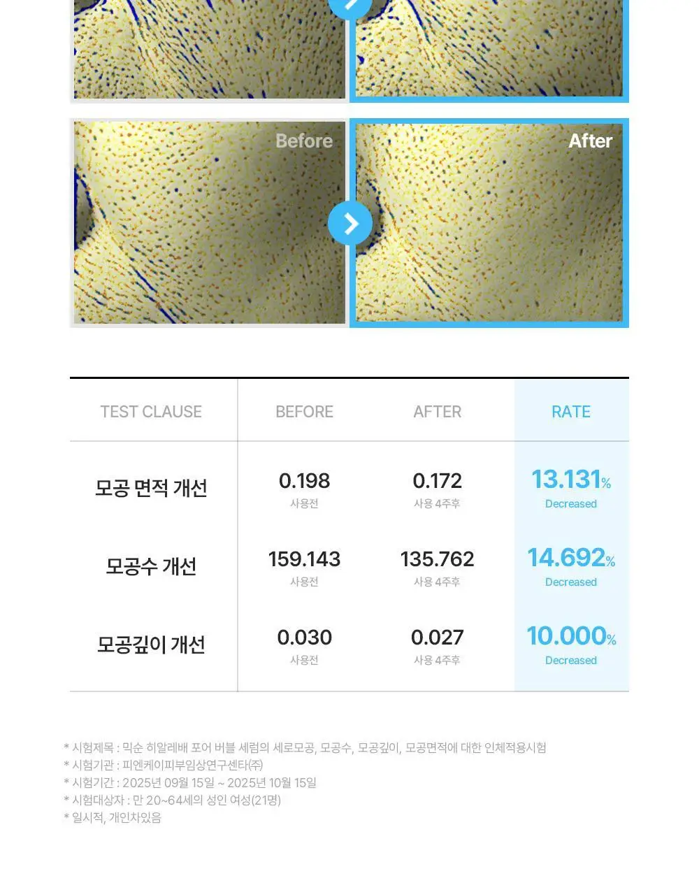 [스칼렛언니PICK] 믹순 히알레배 포어 버블 세럼 70ml 기획 (+팩브러쉬) 상세페이지 28